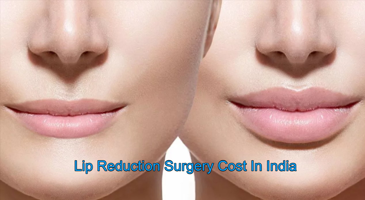 Waht is Lip Reduction Surgery Cost In India?