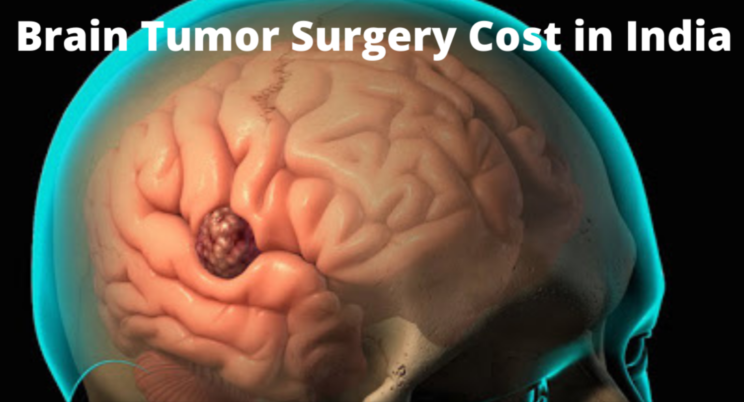 What is the Brain Tumor Surgery Cost In India?